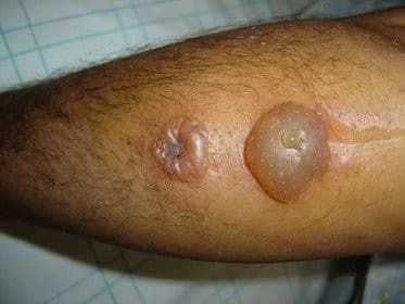 img-20250418-wa02527126470603252155417 RDC : le Nord-Kivu confronté à une nouvelle menace sanitaire avec l’apparition de l’anthrax