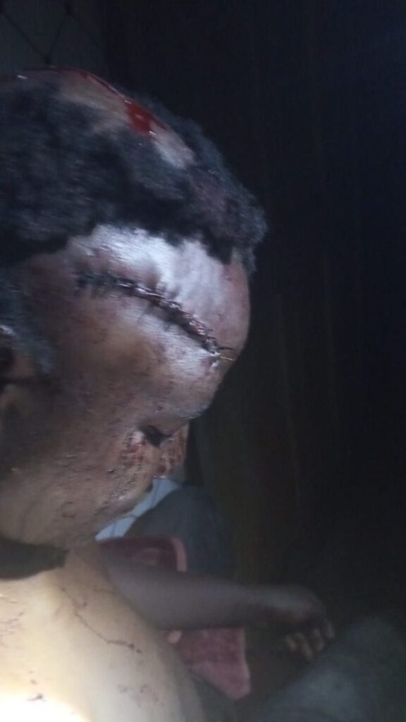 img-20260427-wa01364701568207507139229-576x1024 Wamba: les activités paralysées ce lundi après l'attaque armée contre un opérateur économique à Mambati